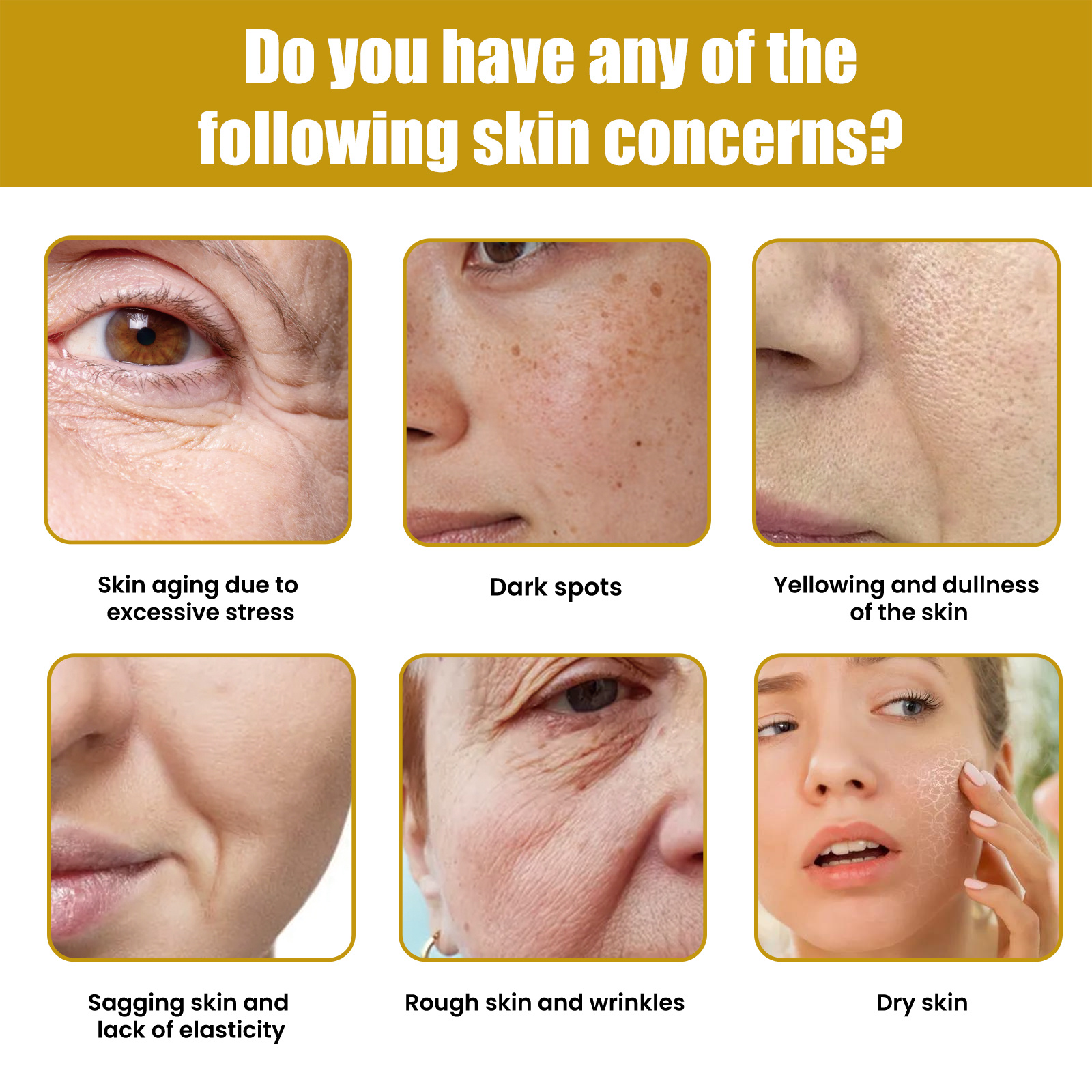 Hoygi Krema Za Lice S Pčelinjim Otrovom, Fade Out Fine Lines Wrinkles Hydrating Moist Firming Skin Bright Skin Anti-Wrinkle Cream - Image 5